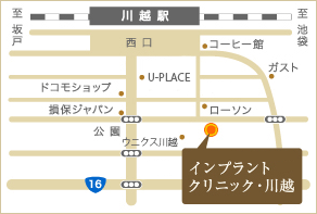 川越,インプラント,埼玉県川越市新宿町1-8-12