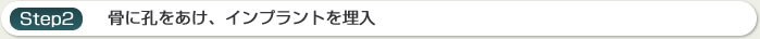 歯を1本失った場合